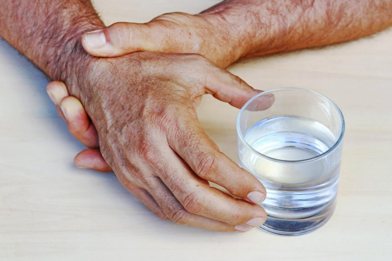Parkinson als Berufskrankheit